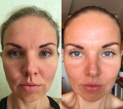 نتيجة قبل وبعد لتحديد الوجه